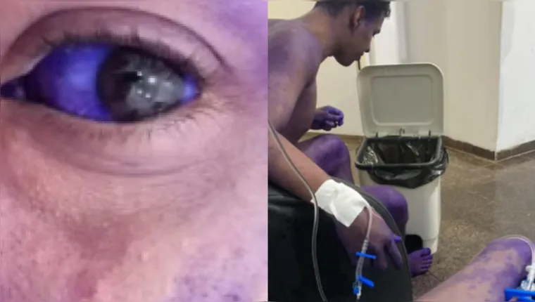 Calouros vão parar em hospital após trote em Rondônia