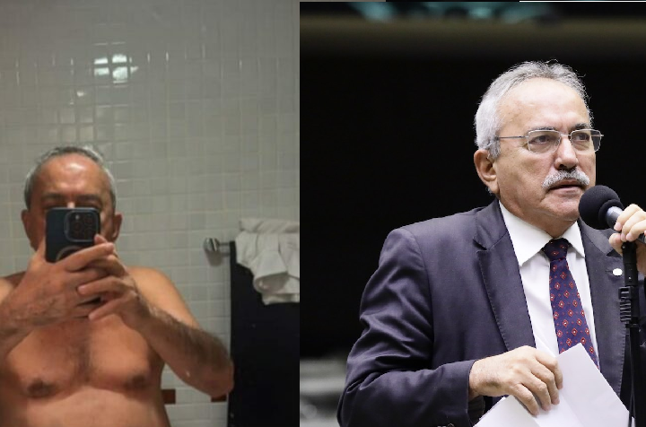 Aos 79 anos, ex-deputado federal posta por engano foto ínt1ma em rede social mostrando tudo; veja