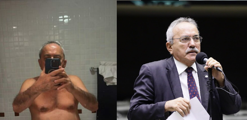 Aos 79 anos, ex-deputado federal posta por engano foto ínt1ma em rede social mostrando tudo; veja
