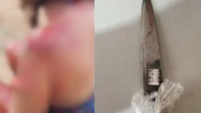 Mulher é ‘retalhada’ pelo próprio filho durante discussão por causa de gato; veja