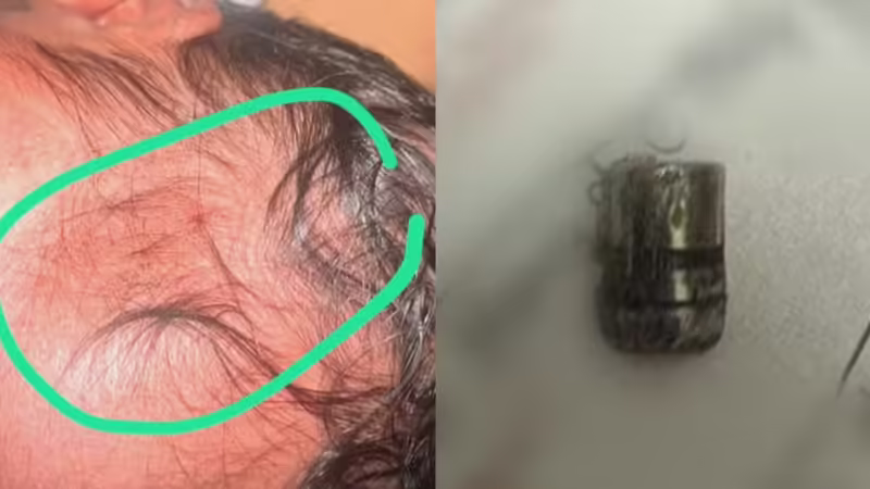 Recém-nascida é atingida por bala perdida em hospital do Recife horas após o nascimento