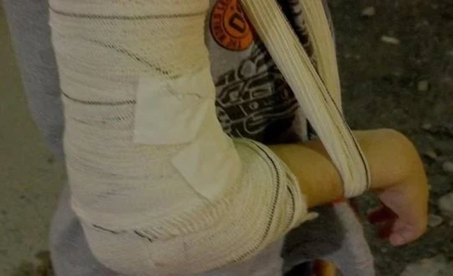 Mulher tem braço quebrado a pauladas pelo marido após sair de culto religioso