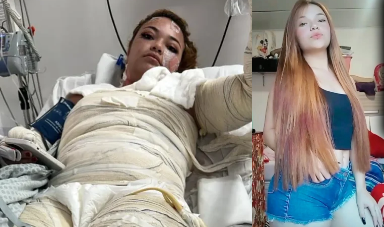 M0rte misteriosa em motel: Jovem mãe m0rre após sofrer que1maduras na banheira